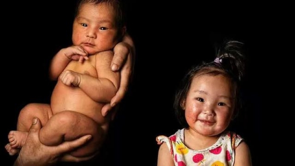 携手防疫抗艾 共担健康责任丨艾滋预防 丝毫不慌-4.jpg