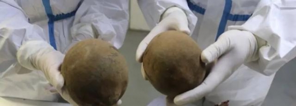 冒充洗衣液企图蒙混过关 上海海关查获5枚猴面包树果实-1.jpg