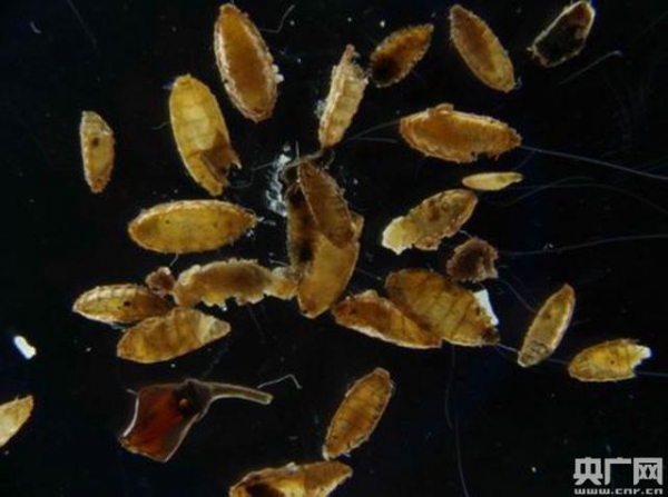 重庆邮局海关首次从入境邮件中截获有害生物蛆症异蚤蝇-3.jpg
