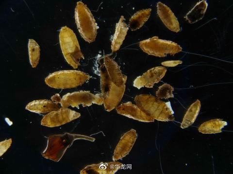 罐头“长蛆”？重庆海关从进境邮包查出265头蛆症异蚤蝇-1.jpg